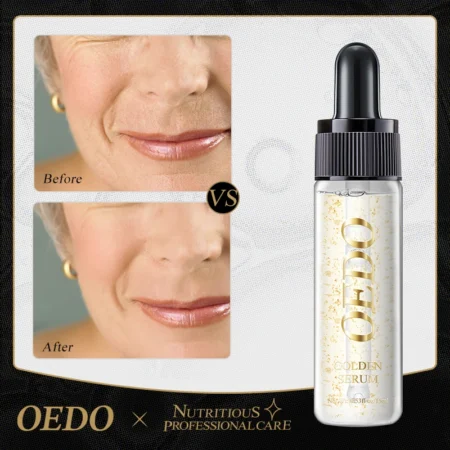 OEDO Gold Moisturizing Serum - Anti-Aging, Whitening & Wrinkle Treatment Essence for Radiant Skin
